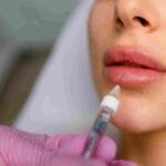 How Much Lip Filler Do You Actually Need? What Miami, FL Experts Want You to Know