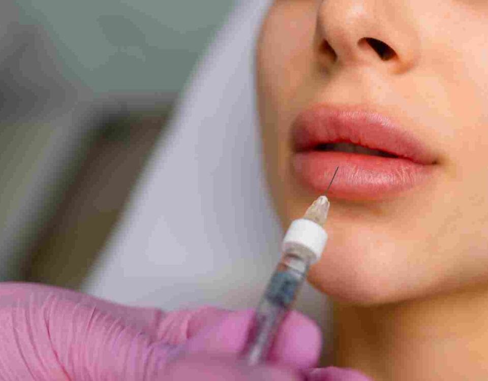 How Much Lip Filler Do You Actually Need? What Miami, FL Experts Want You to Know