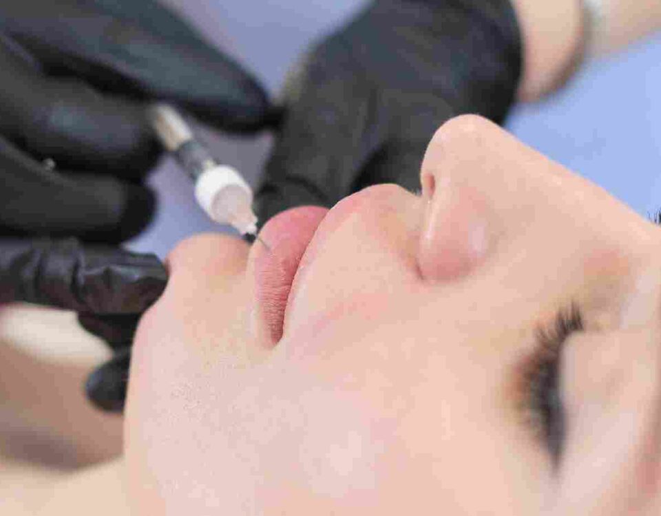 Learn what to expect from hyaluronic acid lip filler — costs, results, aftercare, and why Coral Gables patients love it.