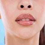 Botox lip flip vs lip filler which is better