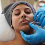 how-many-botox-units-for-lip-flip