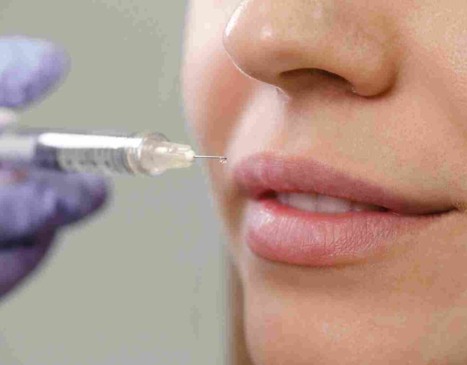 how-much-lip-filler