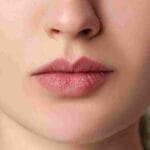 Juvederm vs Restylane for lips which is better