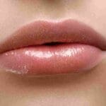 lip filler swelling stages day by day