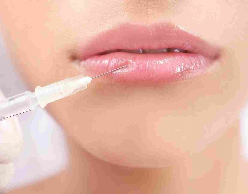 Lip Filler for Thin Lips: Achieve Subtle Natural Results
