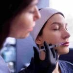 lip-filler-migration-what-causes-it-how-to-prevent