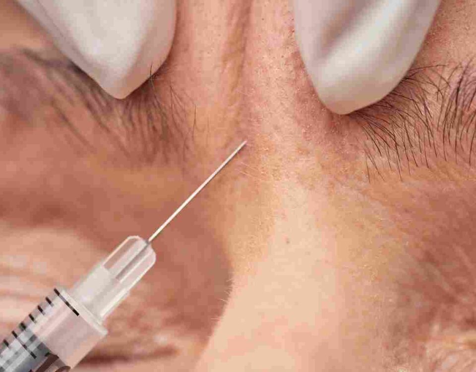 can-aesthetician-inject-botox