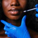 what not to do after lip fillers