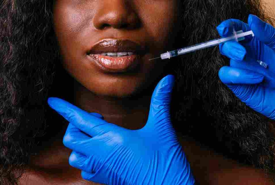 what not to do after lip fillers​