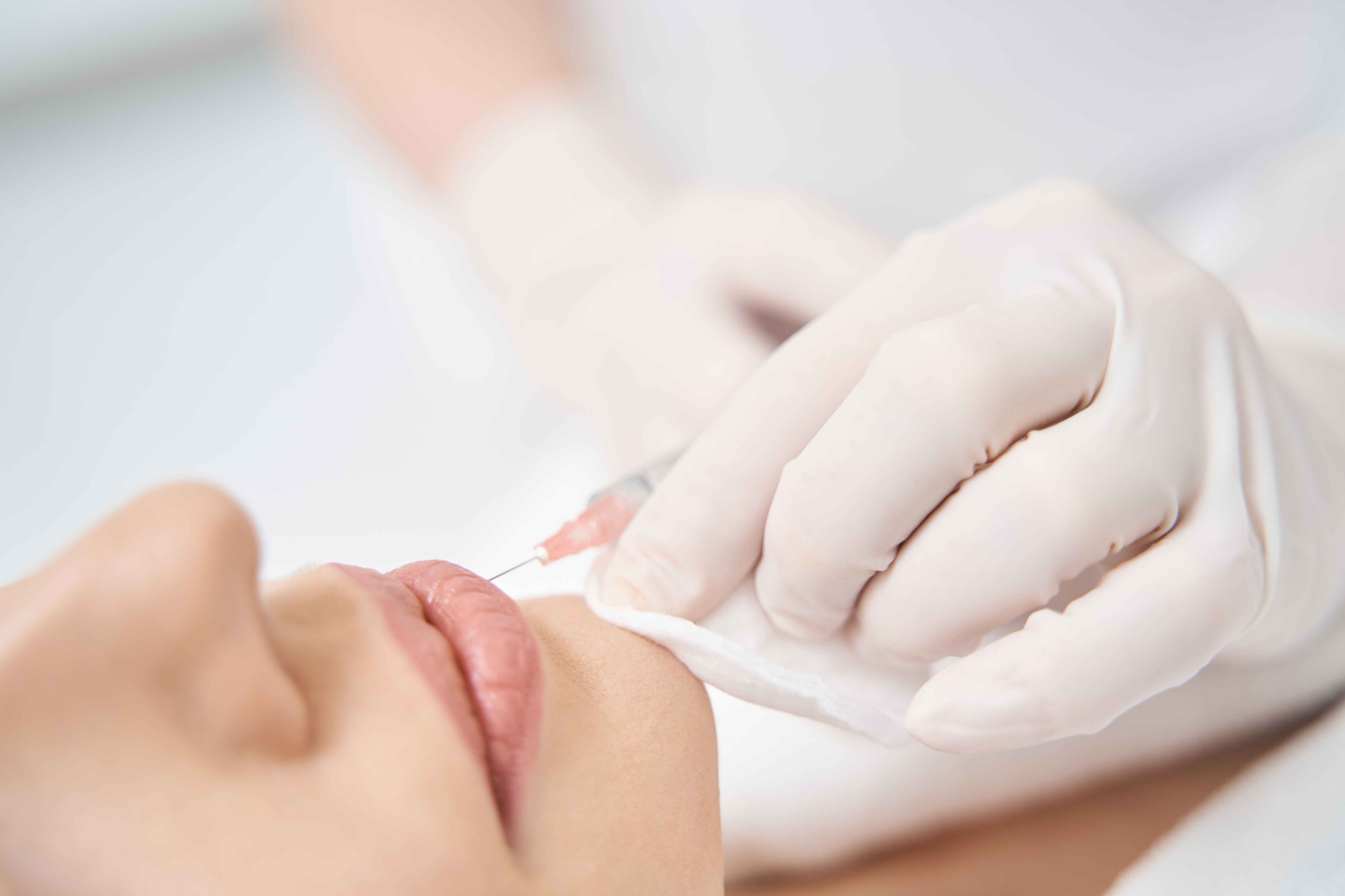 A clean clinical setup for dermal filler correction and hyaluronidase treatment at Pōk Aesthetic Bar in Coral Gables.