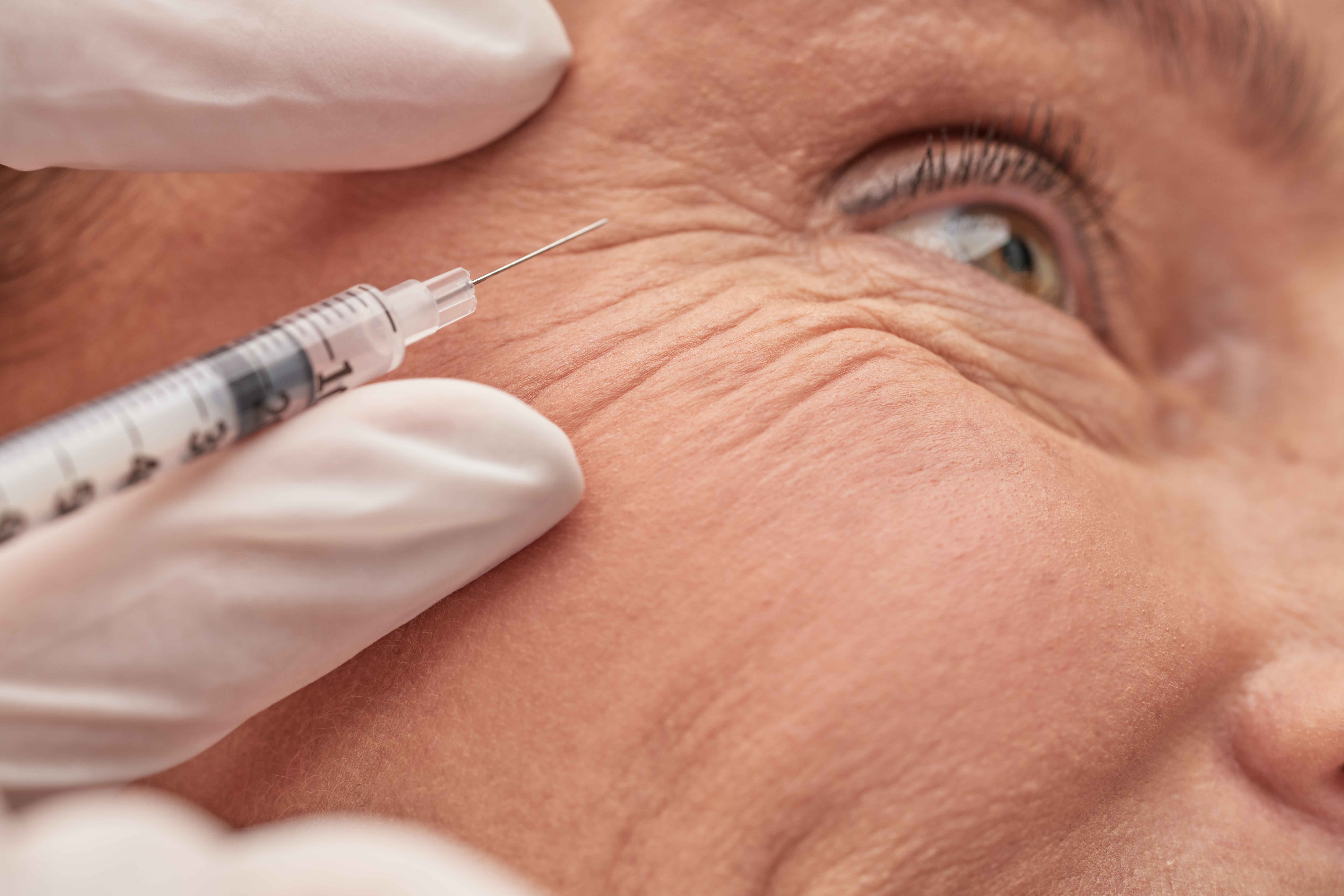 how-much-is-botox-treatment-for-wrinkles