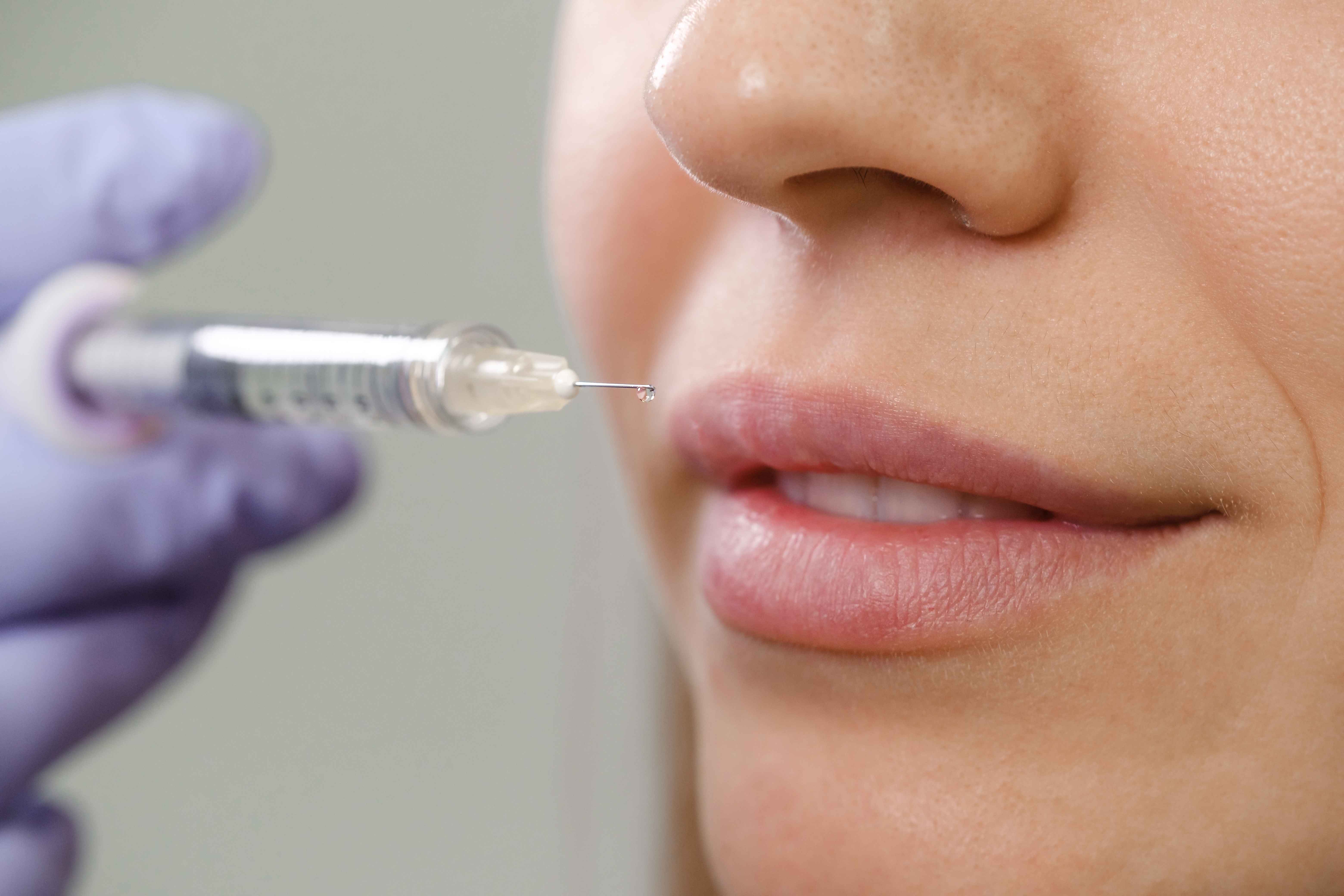 A clean, medical-grade hyaluronic acid dermal filler syringe resting on a pristine clinical tray at Pōk Aesthetic Bar in Coral Gables.