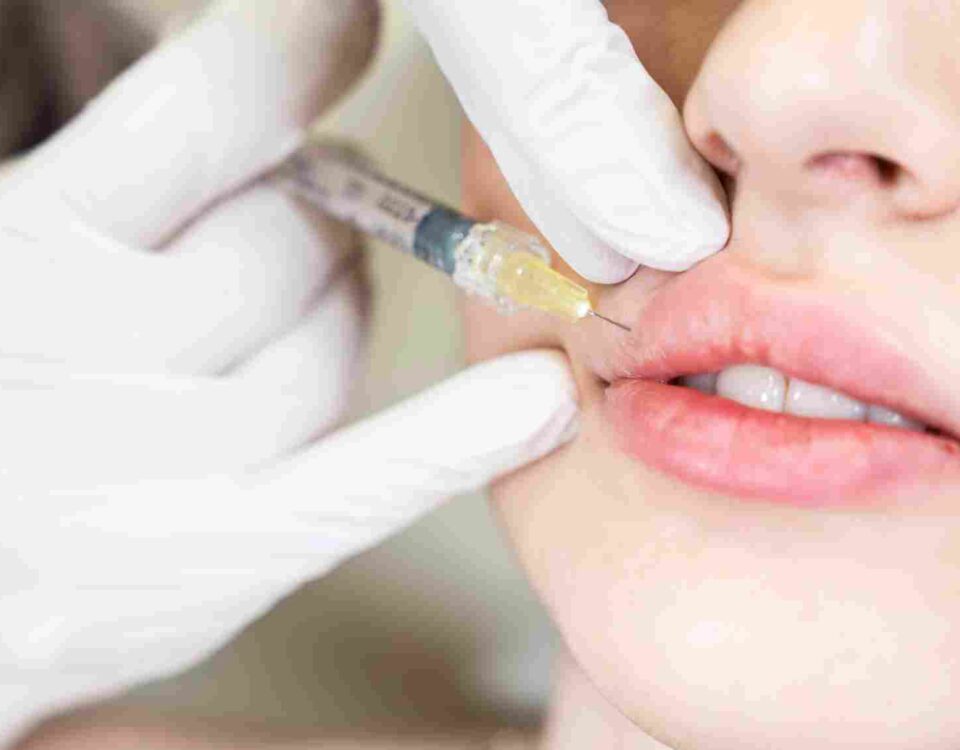 Why Get Lip Fillers? What Patients Say After 1 Year